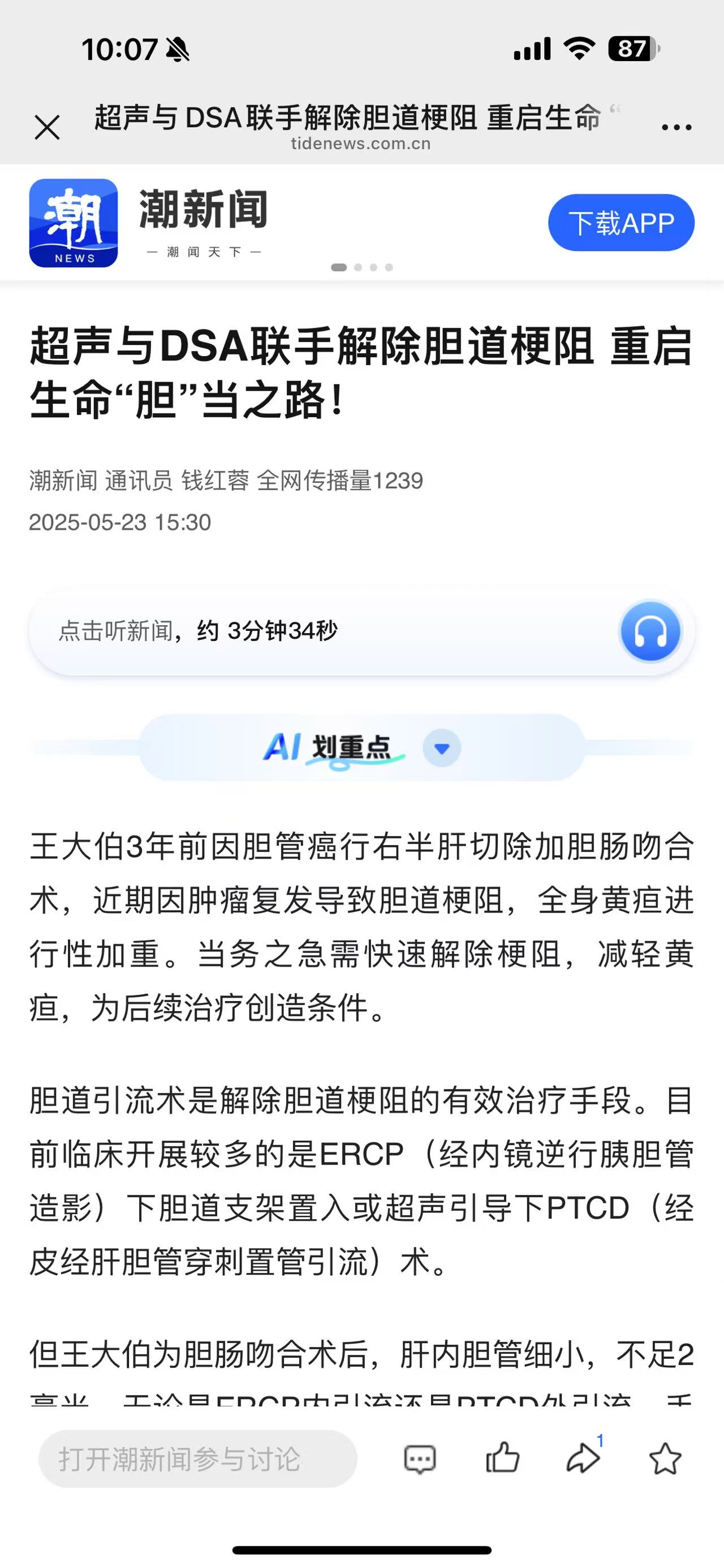 【潮新闻】超声与DSA联手解除胆道梗阻 重启生命“胆”当之路！